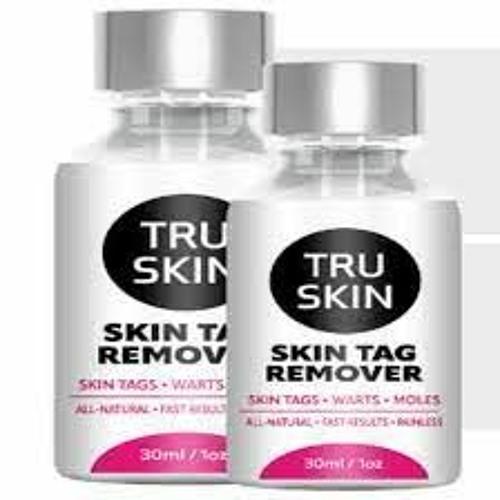 Tru Skin Tag Remover Review